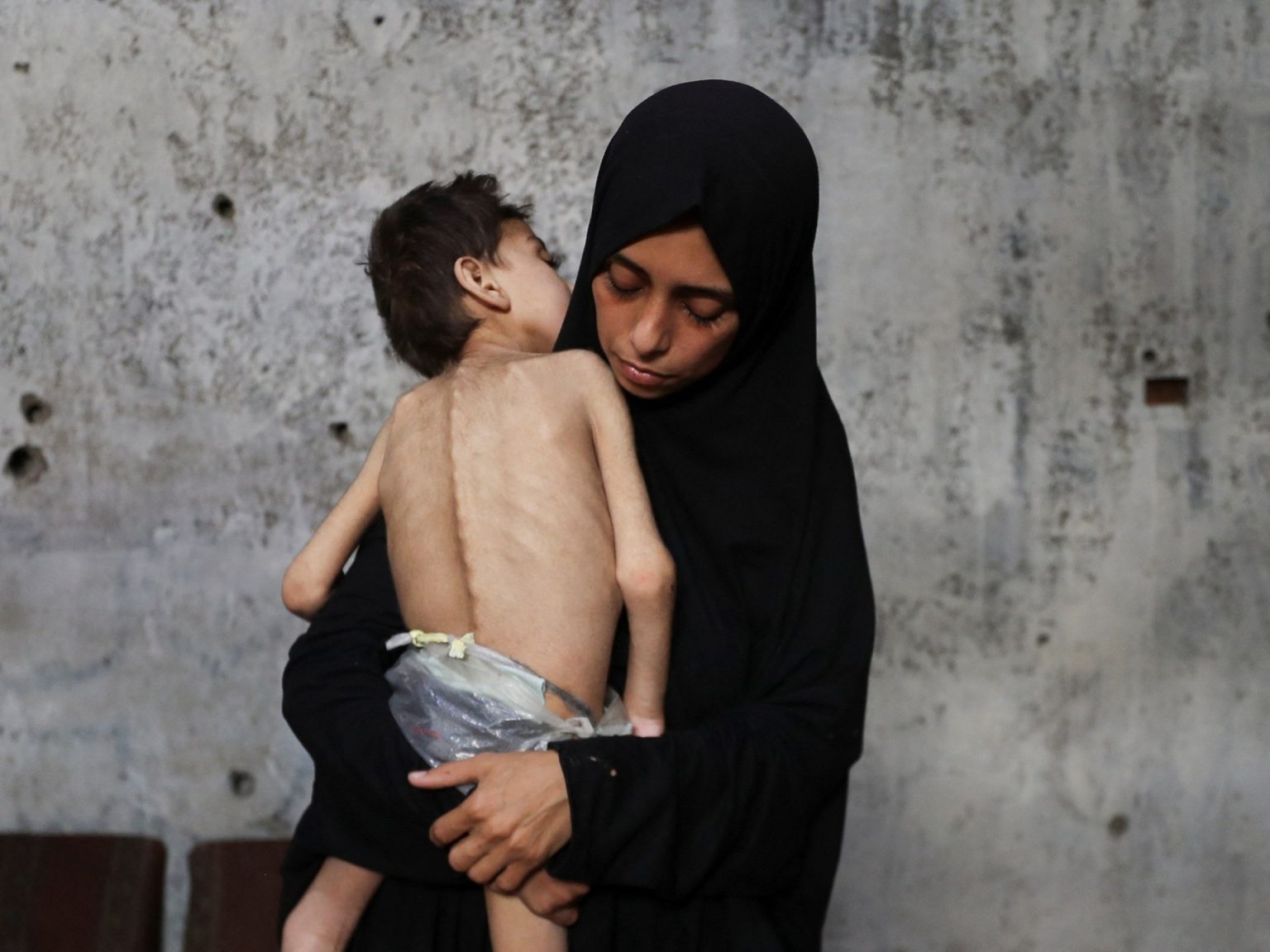 starvation GAZA 1753377598