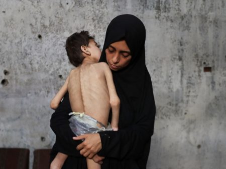 starvation GAZA 1753377598