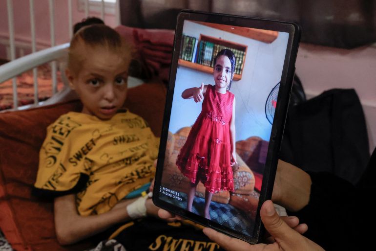 صور الأطفال المجوعين بغزة.. أدلة تدحض ادعاءات نتنياهو 2 Palestinian girl Huda Abu Al-Naja lies on a bed receiving treatment at the malnutrition ward at Nasser hospital as her mother Sumayya shows an image of Huda when she was healthier, in Khan Younis, southern Gaza Strip, August 5, 2025. REUTERS/Hatem Khaled