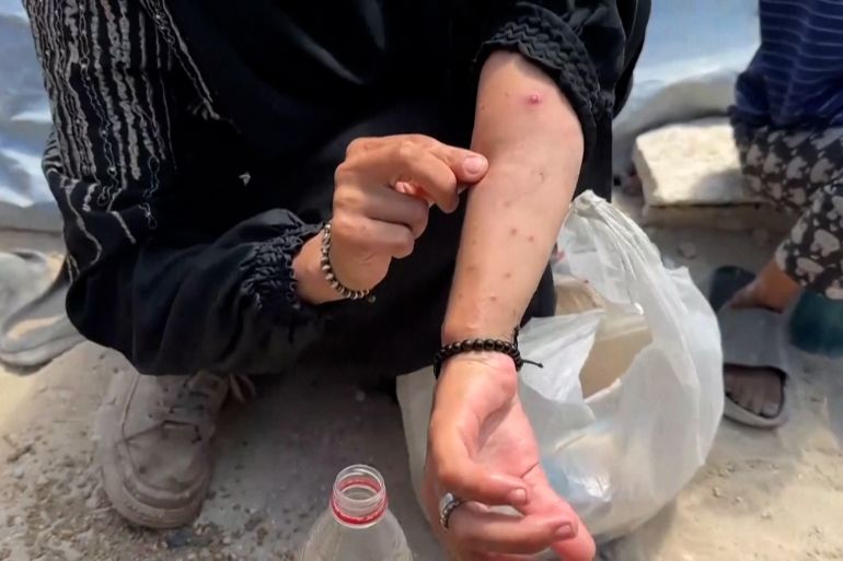 أطفالي ينامون على الماء والملح.. المجاعة تلاحق أهل غزة كل صباح 1 PALESTINIANS GATHERING AT A SOUP KITCHEN IN GAZA CITY TO GET FOOD / PALESTINIAN MOTHER OF THREE, HEBA AL-GHAMARI, TALKING ABOUT DAILY STRUGGLE TO GET FOOD