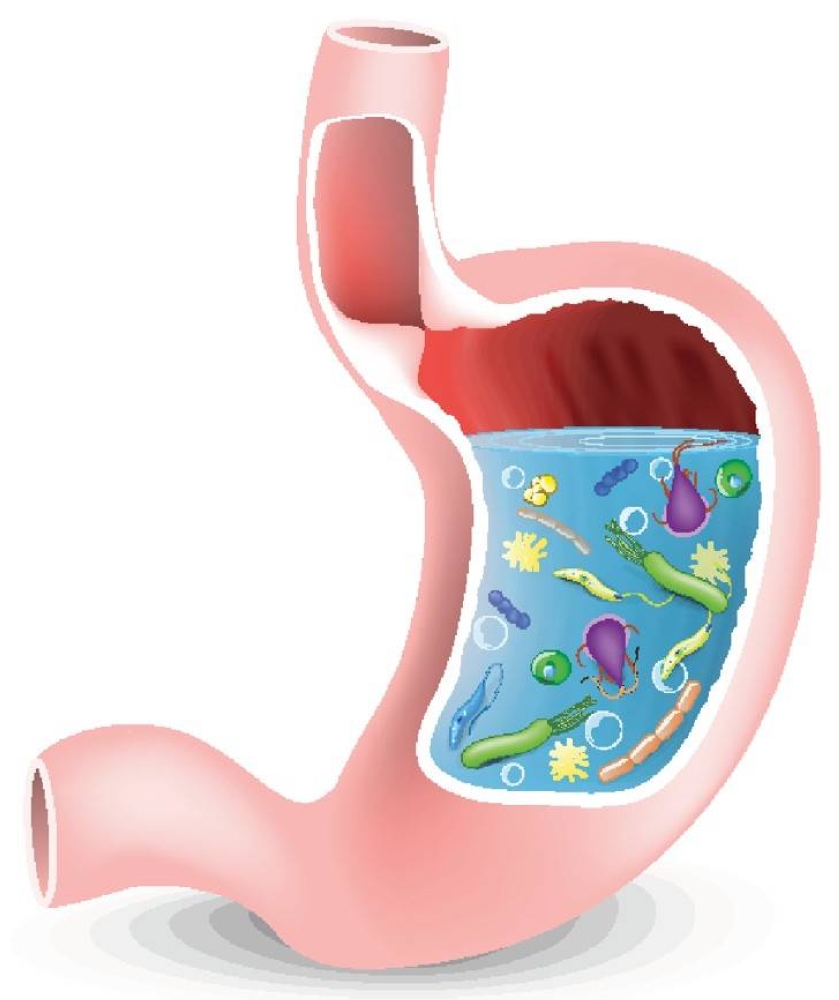 أنت مصاب ببكتيريا المعدة الحلزونية! 2371625
