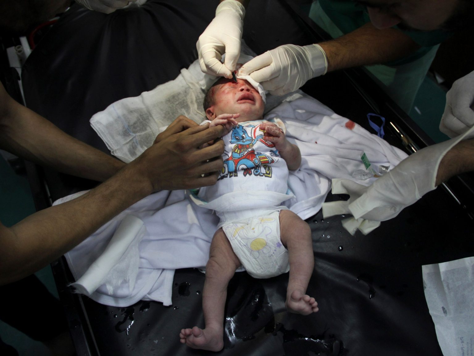 AP156498457053 1711261796