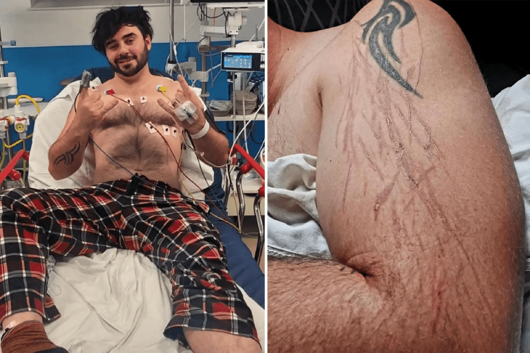 صواعق فائقة إصابة 1710681465