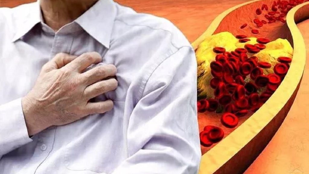 تحذير إلى أصحاب الكوليسترول المرتفع.. انتبهوا إلى هذه الأطعمة لأجل صحتكم 1744197680 image