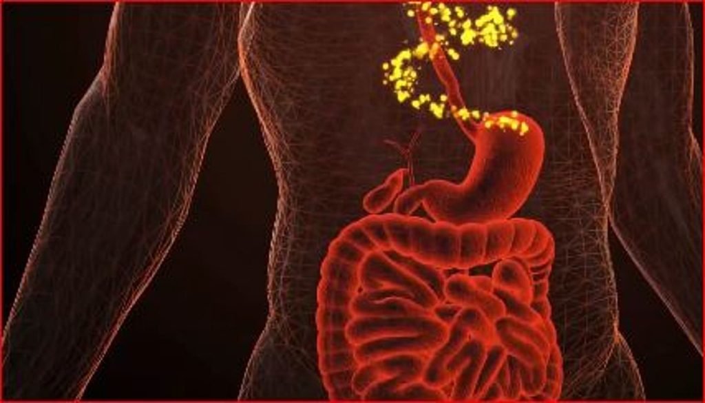 استشاري: القولون العصبي مرض غير عضوي ولا يمكن علاجه جراحياً ajel2F2025 04 062Fdodk3tg32FD8A7D984D982D988D984D988D986