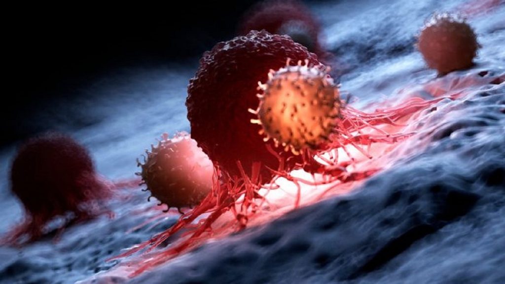 سؤال يؤرق الأطباء: ما الذي يجعل المرض الخبيث يضرب مجدداً بعد الشفاء؟ 1746546734 image