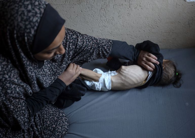 رضيعة فلسطينية تموت جوعا بين ذراعي أمها في غزة المحاصرة 20 Gett946 1746316415
