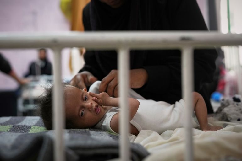 أجساد هزيلة وأعين غائرة.. أطفال غزة أول ضحايا المجاعة 24 Rahma al-Qadi takes care for her 7-month-old daughter Sama, who was born with Down syndrome and suffers from malnutrition, at the malnutrition clinic in Nasser hospital, Khan Younis, Gaza, Thursday, May 1, 2025. (AP Photo/Abdel Kareem Hana)