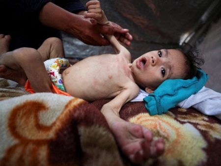 gaza kid hunger 1748712384