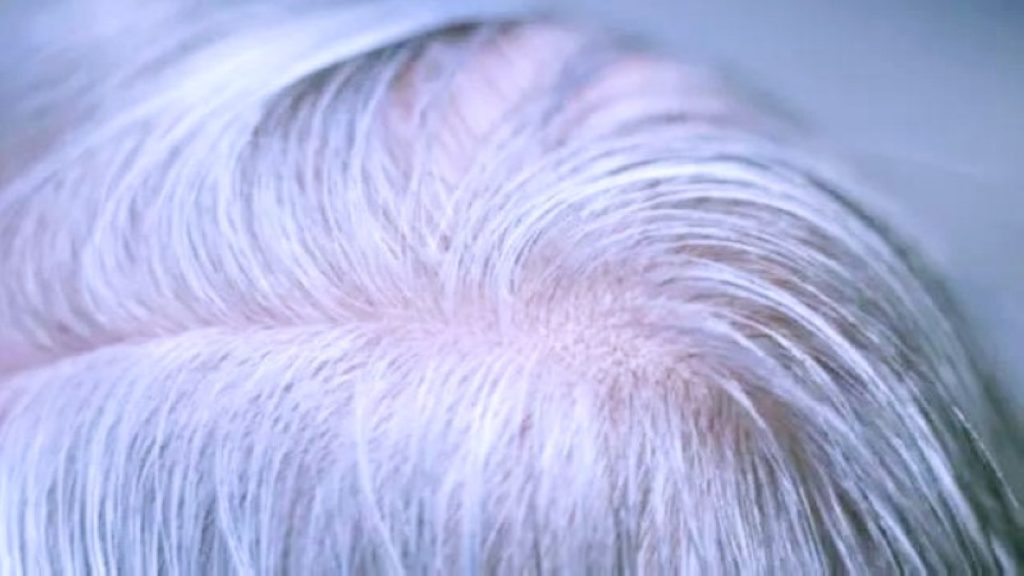 الشيب.. درعٌ خفية تحمي الجسم من سرطان الجلد 2606397