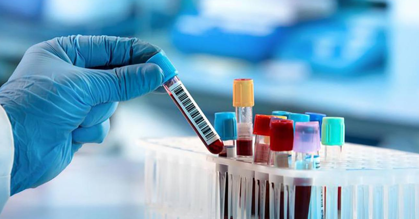 بعد الأربعين .. 4 فحوصات دم مهم جداً أن تعملها بانتظام 1763280586 image