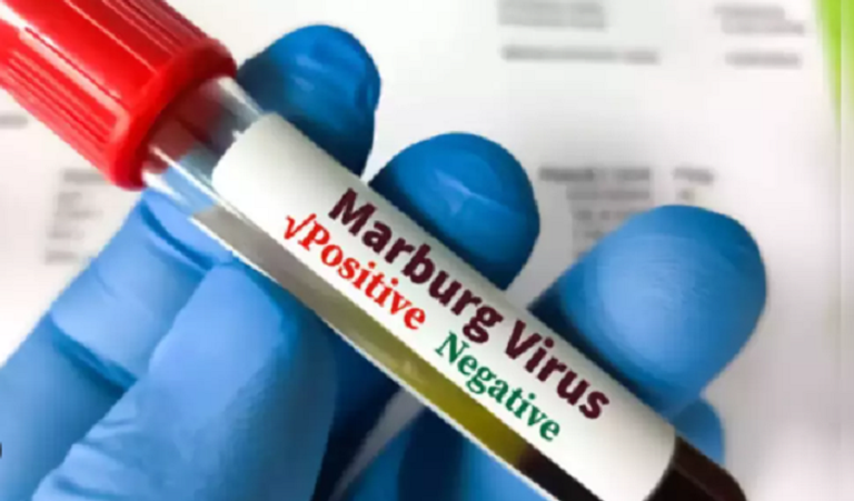 الصحة المصرية تعلق على مخاوف انتشار فيروس قاتل في البلاد 1763559596 image