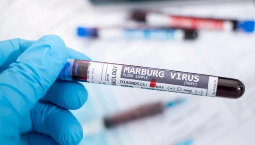 إثيوبيا تعلن تفشي وباء «ماربورغ» – أخبار السعودية 2615487.webp