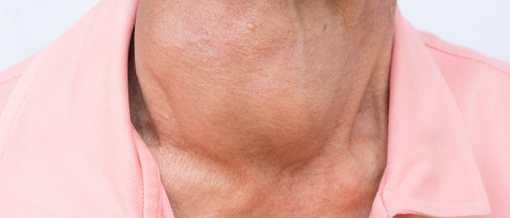 أستاذة بالطب توضح أثر اضطرابات الغدة الدرقية على الوزن ajel2F2025 11 192Fpa3f1foh2FD8BAD8AFD8A9