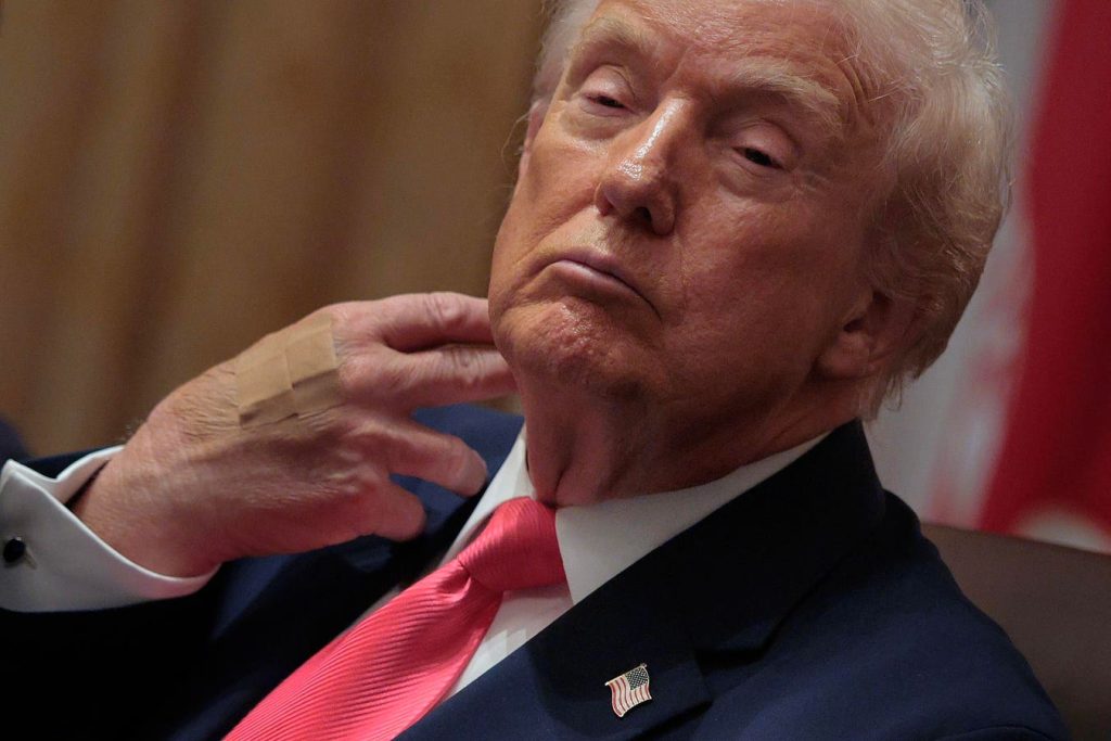 ترامب يظهر بيده المضمدة لليوم الثاني على التوالي 1764813597 0x0