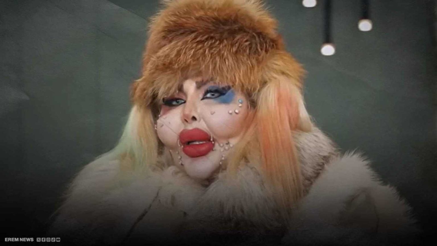 شابة إيرانية مهووسة بشكلها: أجريت 388 عملية تجميل ولم آكل شيئاً منذ 8 سنوات ! 1765770892 image