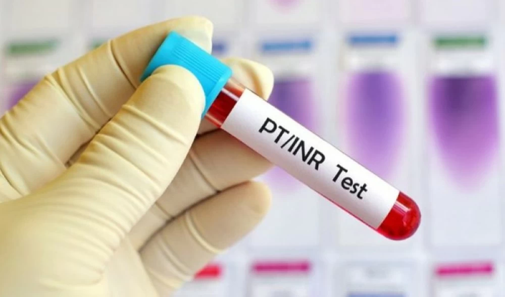 وفاة مريض خلال دراسة دواء لسيولة الدم – أخبار السعودية 2635648.webp