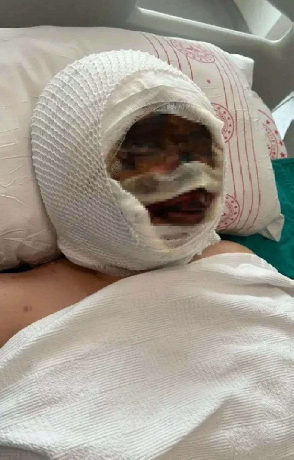 تركي يقيّد زوجته ويسكب عليها «أسيداً» محا ملامحها.. لأنها طلبت الطلاق – أخبار السعودية 2652657.webp