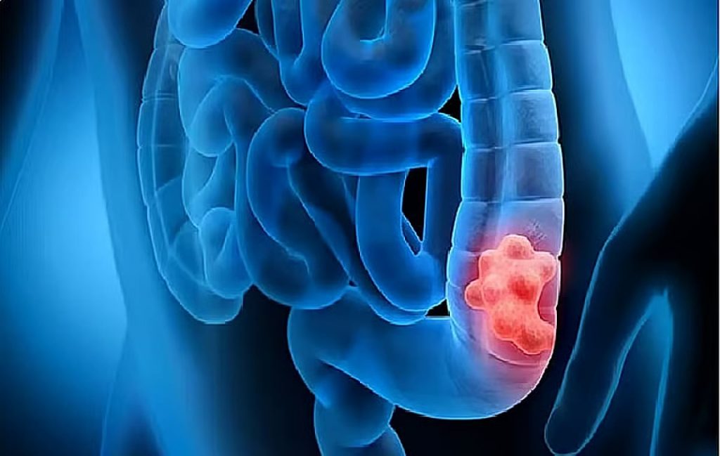 ajel2F2026 01 062Fnbnceyxn2Fajel2025 10 07sror5gldD982D988D984D988D986.avif