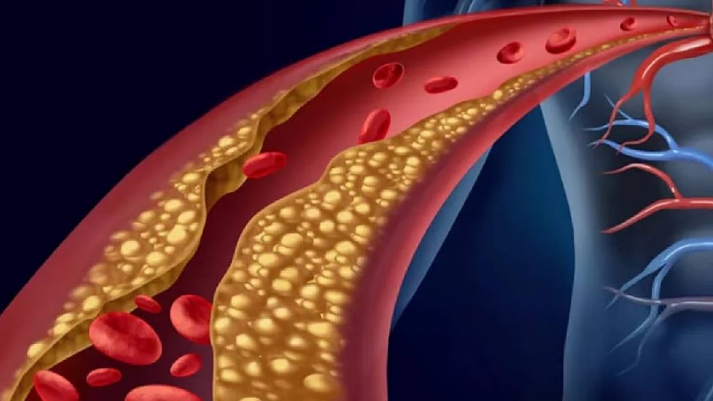 ajel2F2026 01 072Fq6zkq1mw2Fajel2022 0141ed6d7d 4956 495f 9f0c 48d9a1cf243420220112T111948002.avi