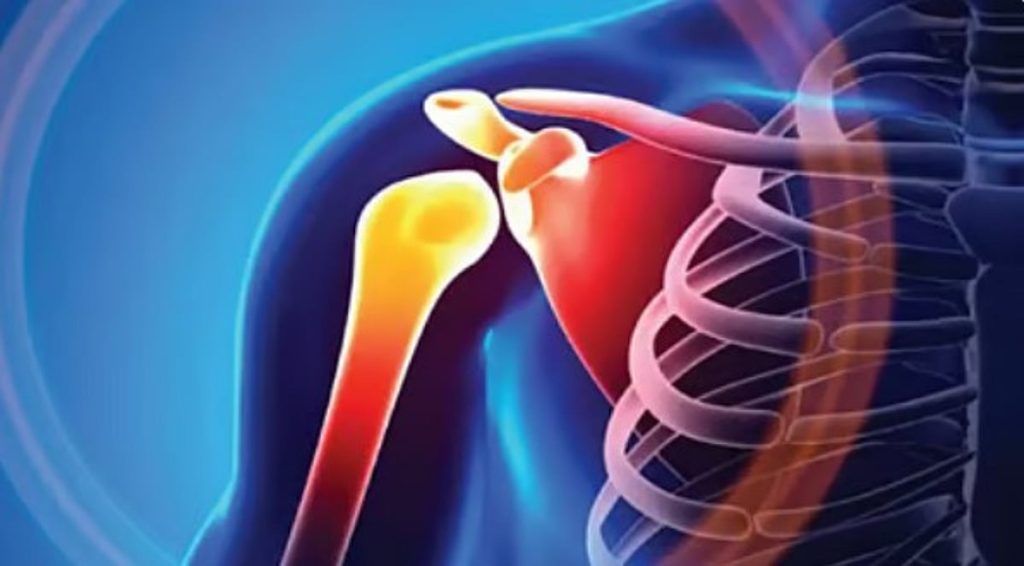 ajel2F2026 01 102Fry1y48qi2FD987D8B4D8A7D8B4D8A9 D8A7D984D8B9D8B8D8A7D985.j