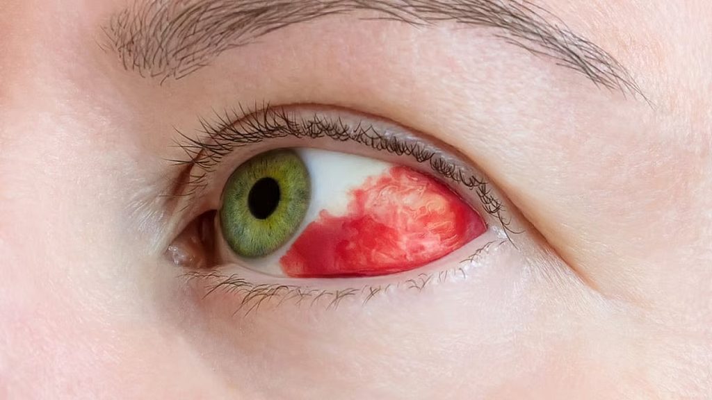 ajel2F2026 01 192F1u1g29bd2Fajel2023 058ea465a0 815f 4c11 804a 7cbe463d21bd173195702eyebleedingre