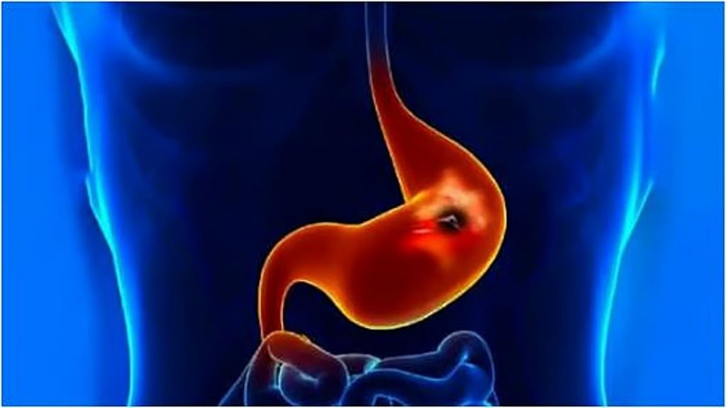 ajel2F2026 01 212Fs5q05t8b2Fajel2025 08 316zvpa38zD8ACD8B1D8ABD988D985D8A9 D8A7D9